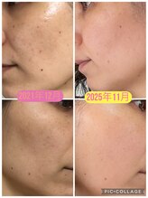 アンジュブリアン(Ange brillant)/毎日使うお化粧品