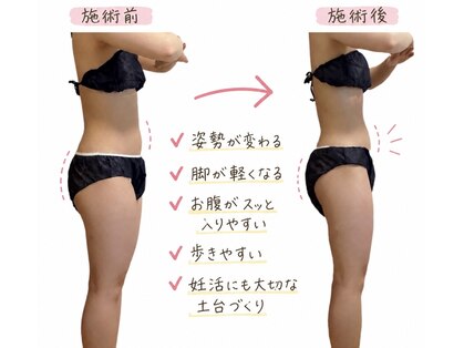 リュミエール(umiere)の写真