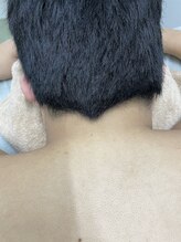 ナノハナ/鹿沼市の全身脱毛のナノハナ