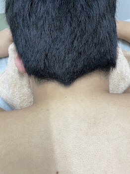 ナノハナ/鹿沼市の全身脱毛のナノハナ