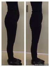 リッツ 浦和ボディ店(Ritz)/【フェムセラの効果】