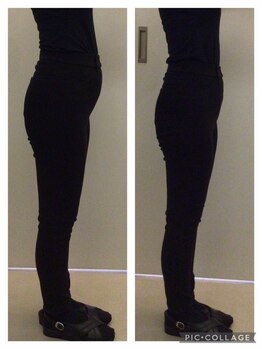 リッツ 浦和ボディ店(Ritz)/【フェムセラの効果】