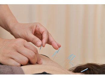 すばるはりきゅうマッサージ整骨院/鍼、肩こり