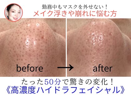 コタ(COTA)の写真