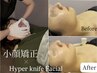 【ハンドと機械の二刀流】当日から実感やって後悔なし！輪郭と顔の肉感を撃退