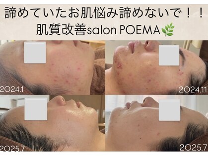 ポエマ(POEMA)の写真