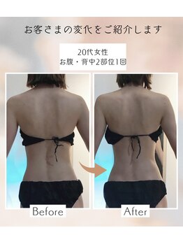 アンドユー(&U)/