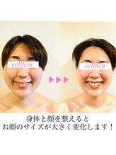 セルフィッシュ(Cellfish)/小顔×美容整体
