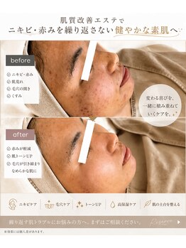 シエル(C i E L.)の写真/お客様の"なりたい"キレイを叶えるプライベートサロン♪お悩みにとことん寄り添った施術で高い満足度◎