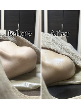 フィール(feel)/整体+リンパ Before & After