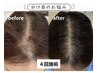 【10年前の髪質へ】抜け毛/髪質ボリュームのお悩みの方にプロセル育毛促進