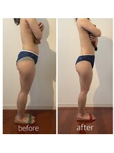 バンブー(bamboo)/筋膜リリース5回＋リンパ10回