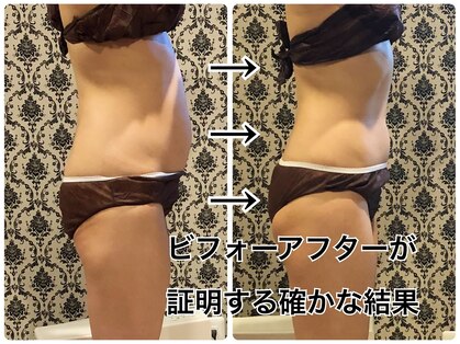 リュイール(LUIRE)の写真