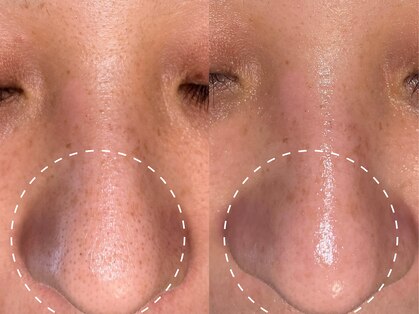 ナポデイズ(NAPODAYS)の写真