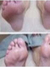 リゼラアンドコー 船橋店/ドイツ式フットケア専門店