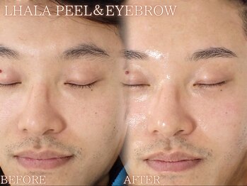 レイネ(REINE)/韓国肌管理★ララピール