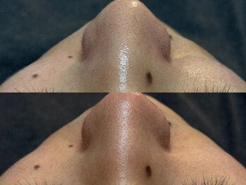 リアン 本町(Lien.)/リジュラン導入で肌艶2トーンUP