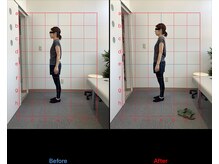 リード整骨院(LEAD整骨院)/姿勢改善、猫背、反り腰