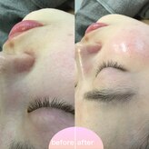 ミュー 植田店(mieux)