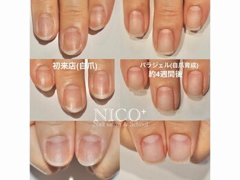 自爪育成中（クリア仕上げ）