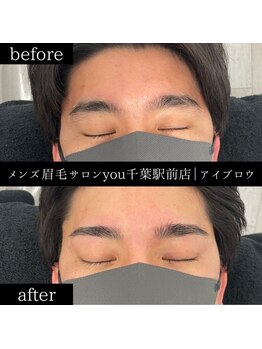 ユー 千葉駅前店(you)/ビフォ－アフター写真