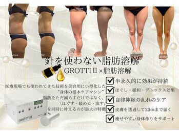 カーラ(cara)の写真/脂肪分解美容液×マシンで気になる脂肪を撃退しサイズダウン！リバウンドしにくく、効果をスピード実感☆