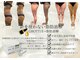 カーラ(cara)の写真/脂肪分解美容液×マシンで気になる脂肪を撃退しサイズダウン！リバウンドしにくく、効果をスピード実感☆