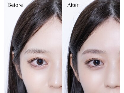 シユ(siu)の写真