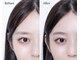 シユ(siu)の写真