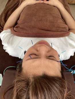 ハリファ鍼灸院 横浜関内院(HariFa鍼灸院)/美容施術