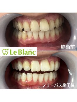 ルブラン 奈良店(Le Blanc)/ブライダルコースも人気です！