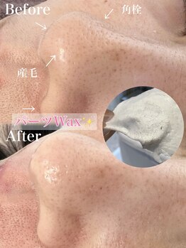 ミュリー(MuRIR)/