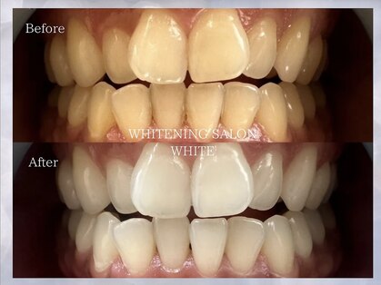 ホワイトニングサロン ホワイト 津山店(WHITE)の写真