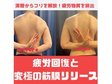 月香館 大阪店の雰囲気（【コリ疲労回復】コリでお悩みの方へおすすめの筋膜リリース☆）