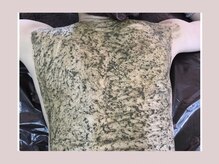 サロン ド シェリー/背中のハーブピーリング