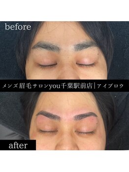 ユー 千葉駅前店(you)/ビフォ－アフター写真
