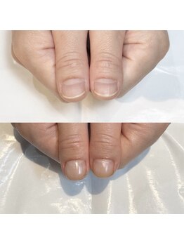 キュア(Cure.)/健康で美しい爪に育むネイル