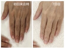 キレイテ 上野店/50代/7回目【ハンドケア上野】