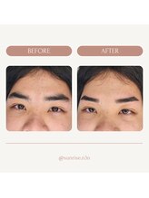 サンライズ(SUNRISE)/