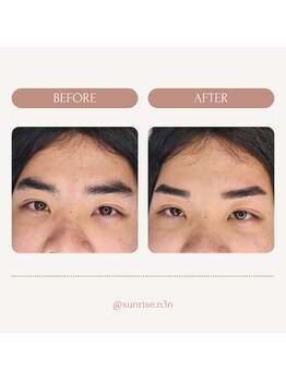 サンライズ(SUNRISE)/