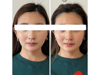 メディカルエース(MedicalAce)/看護師ハイサーマ