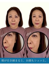 ハリラボ(hari Lab.)/【お客様の声】