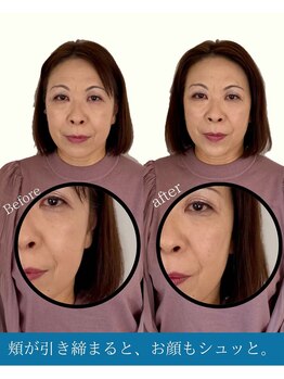 ハリラボ(hari Lab.)/【お客様の声】