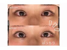 リヒト(Licht)/アイパワーエステ