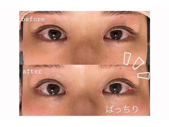 リヒト(Licht)/アイパワーエステ