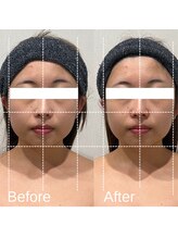 エステティックサロン ラ ベルタ(Esthetic Salon La Belta)/華奢みえコルギ