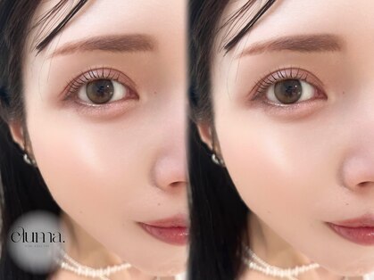 エルマ(eluma.)の写真