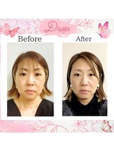 ドロップ(Drop)/老ける原因はむくみ！！！