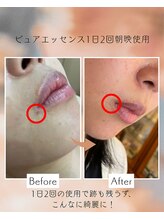 メディカルサロン フィオレ(fiore)/どんなお悩みも魔法の美容液で！