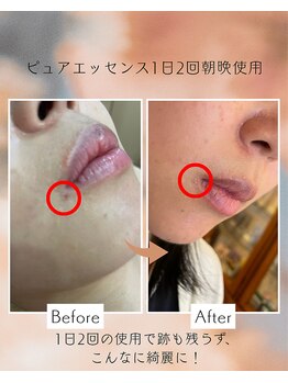 メディカルサロン フィオレ(fiore)/どんなお悩みも魔法の美容液で！